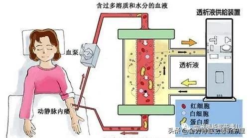 血液净化数据统计（血液净化在急诊的临床应用）