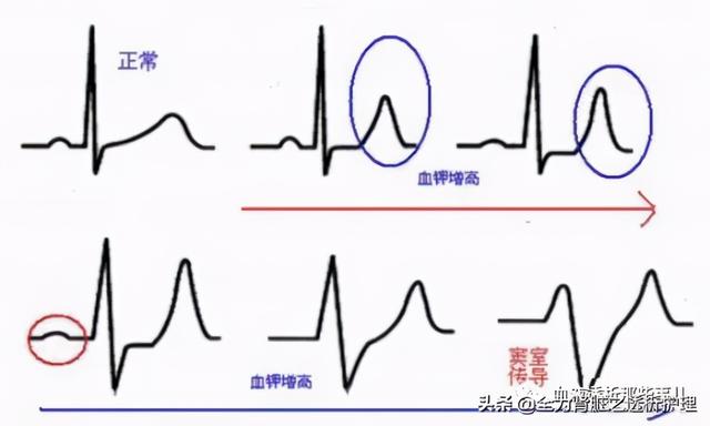 血液净化数据统计（血液净化在急诊的临床应用）(7)